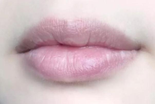 唇纹深怎么办怎么去除 唇纹深怎么涂口红