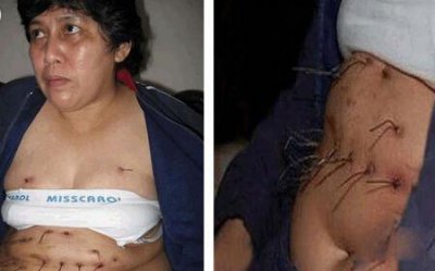 ​揭秘能把人吓半死的22个惊人怪胎