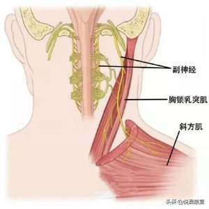 ​副神经解剖与损伤