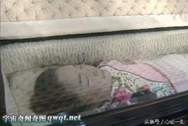 一代歌后邓丽君尸检照片曝光 死因种种让人难猜