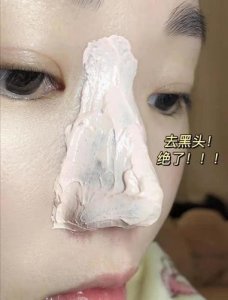 ​七种有效去黑头方法（有效去黑头的四种方法）