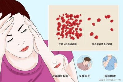 ​贫血怎么办男人怎么补血？贫血怎么办该吃些什么