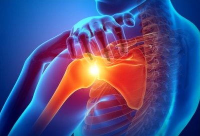 ​肩周炎为何久治不愈，可能忽视了这个重要部位