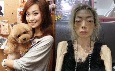 ​伍智恒: 嫁入豪门8年色衰被抛弃，牙齿掉光胃被切除，体重只剩44斤