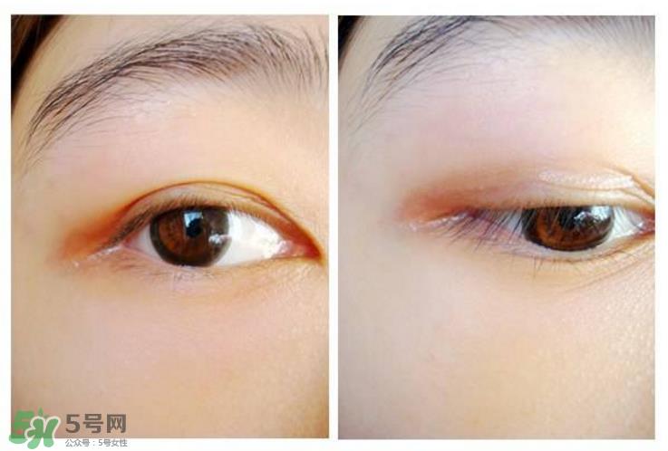网红双眼皮贴大推荐？双眼皮贴正确贴法