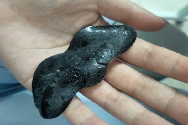 黑头贴的使用方法 黑头贴应该怎么使用 黑头贴的使用方法 黑头贴应该怎么使用