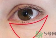 如何快速消除眼袋?快速消除眼袋的小窍门