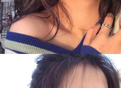 ​接吻会传染艾滋病吗 接吻是否会传染艾滋病