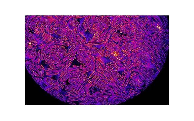 哪款减肥药好 哪款减肥药好